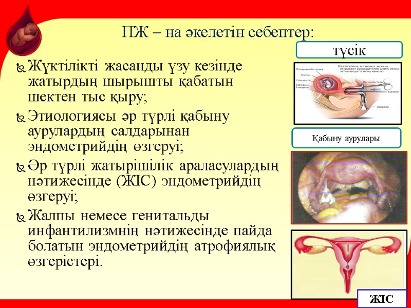 ПЖ – на әкелетін себептер: Жүктілікті жасанды үзу кезінде жатырдың шырышты қабатын шектен тыс